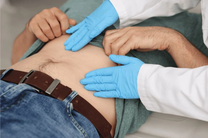 Doctor examining a swelling on a patient's abdomen