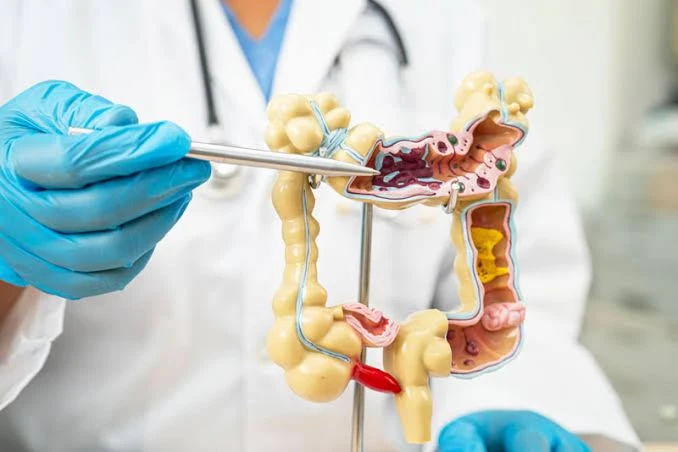 Doctor explaining colon anatomy model